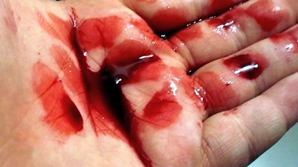 ¿Qué es la sangre de grado?2